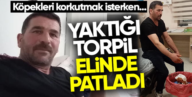 Yaktığı torpil elinde patladı…