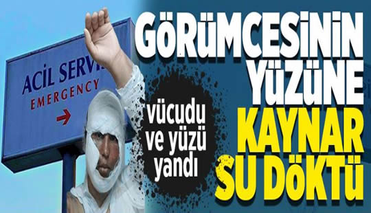 Görümcesinin yüzüne kaynar su döktü!