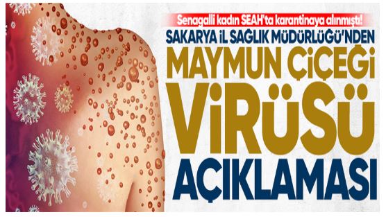 Sakarya İl Sağlık Müdürlüğü’nden “maymun çiçeği virüsü” açıklaması!