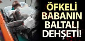 Geyvede’de Öfkeli Babanın Baltalı Dehşeti!